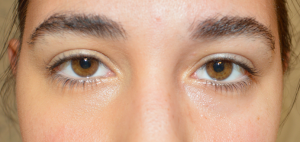 how to cover dark under eye circles up close concealed eye comparison